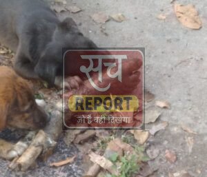 अस्पताल की लापरवाही: नाले में फेंका कटा हुआ मानव पैर