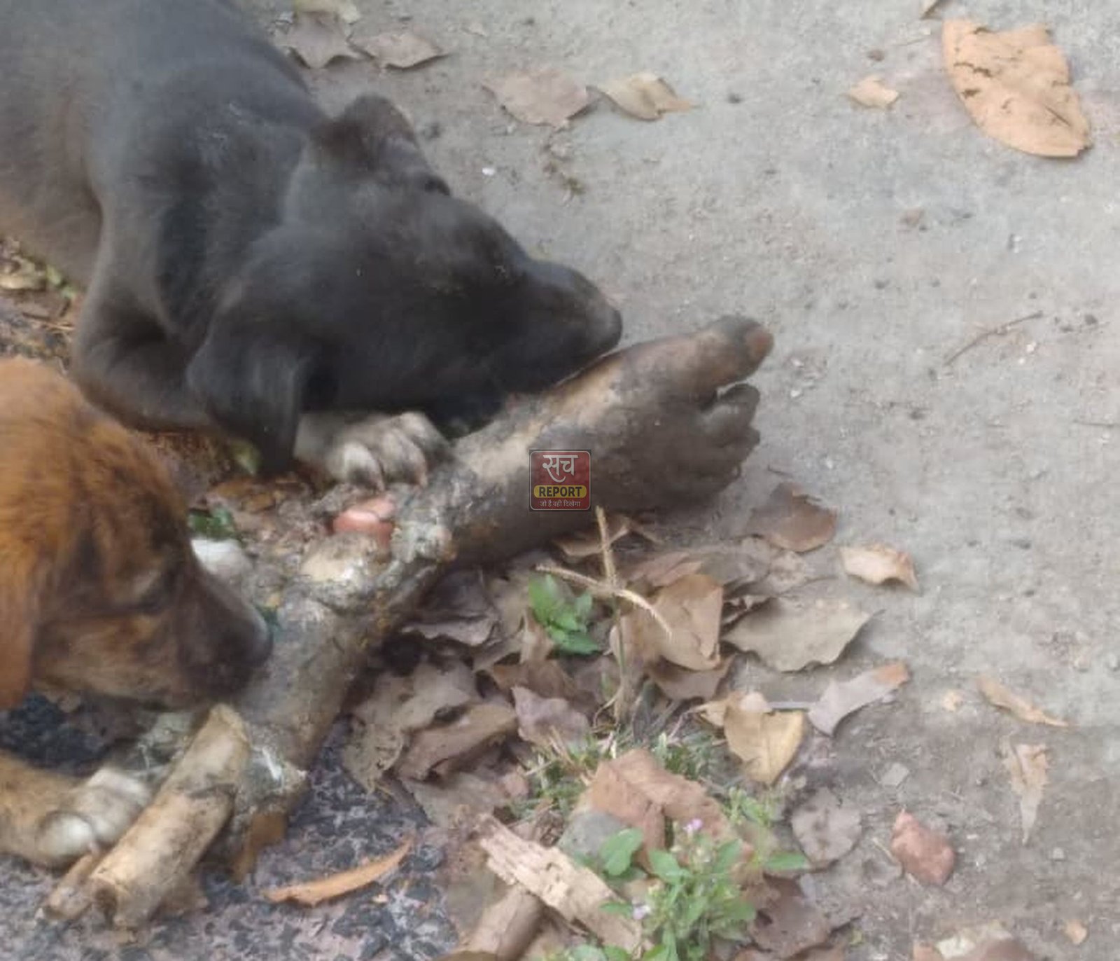 अस्पताल की लापरवाही: नाले में फेंका कटा हुआ मानव पैर